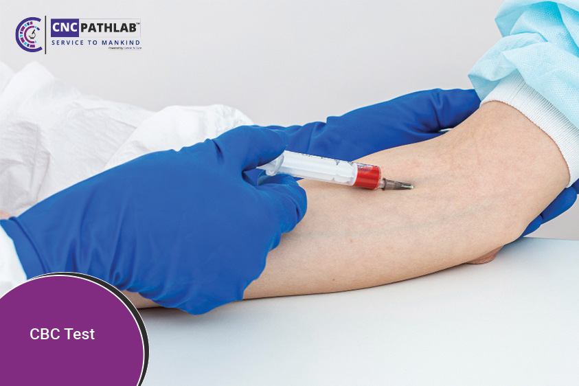 Understanding the Complete Blood Count CBC Test: What It Tells You